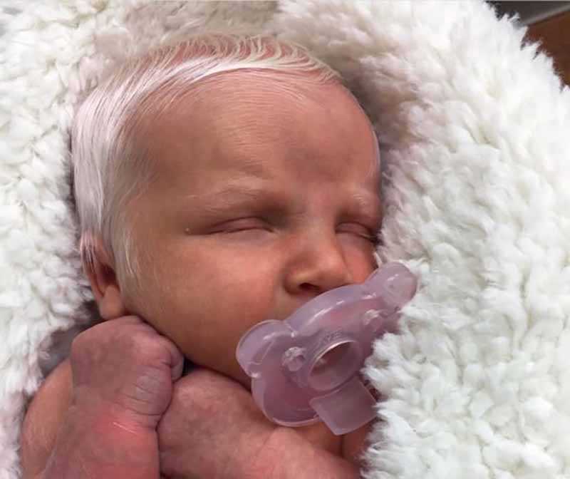 This Boy Was Ridiculed as a Baby for Looking Like a Grandpa. Now He’s Redefining Beauty